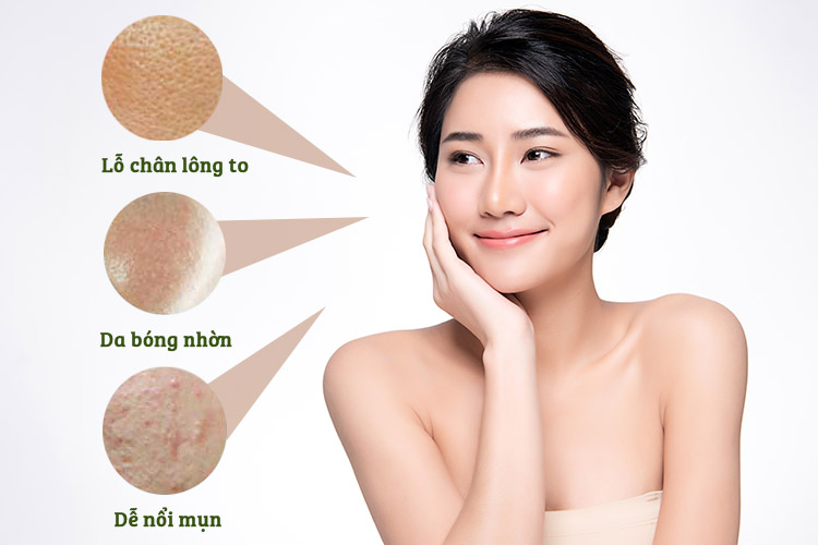 Đặc điểm của làn da dầu