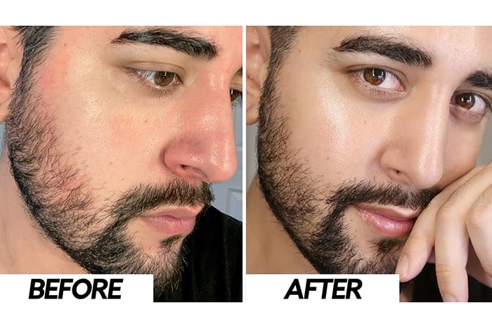 Niacinamide có những tác dụng rất tốt cho làn da của bạn