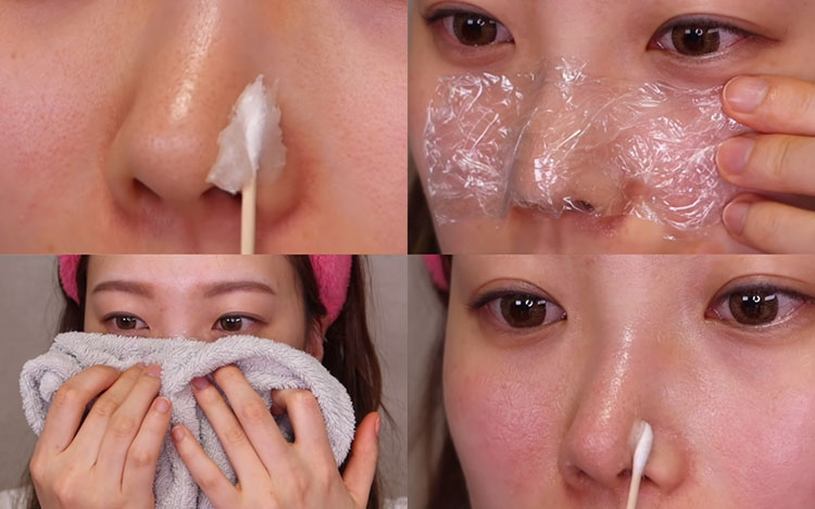 Hướng dẫn cách trị mụn đầu đen ở mũi bằng vaseline